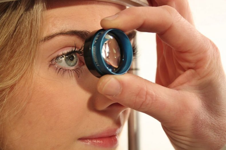 Гониоскопия глаза