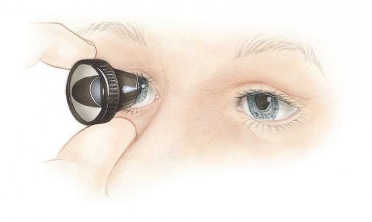 Циклоскопия глаза